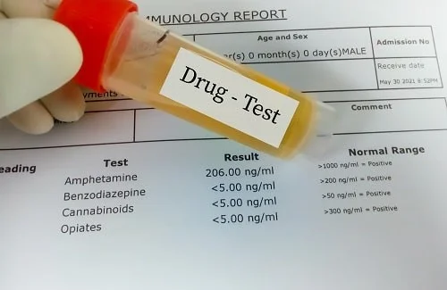 Drug test results showing elevated amphetamine levels in male infant's immunology report.