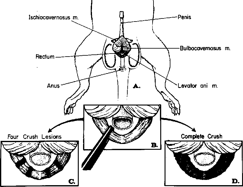 Hershberger Test: How Scientists Measured Anabolic Activity 3 An anatomical illustration highlighting the levator ani muscle in male rats, a key tissue measured for anabolic activity in the Hershberger assay.