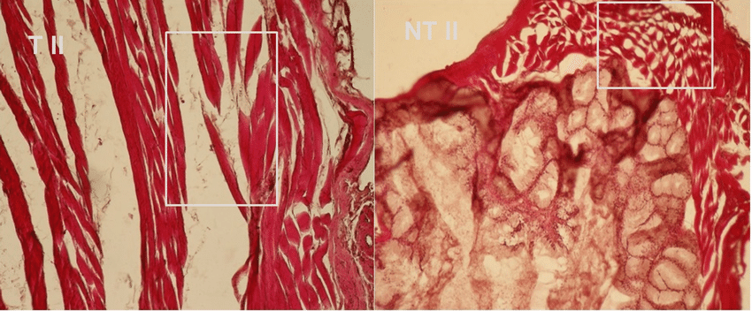 Hershberger Test: How Scientists Measured Anabolic Activity 2 Levator ani muscle and bulbourethral gland histological sections in castrated males from NTII group (HE staining, ×200). Massive dilacerations and ruptures of striated muscular fibbers in levator ani muscle samples and muscular fibbers rarefaction and fluid accumulation increase in volume and weight to bulbourethral glands.