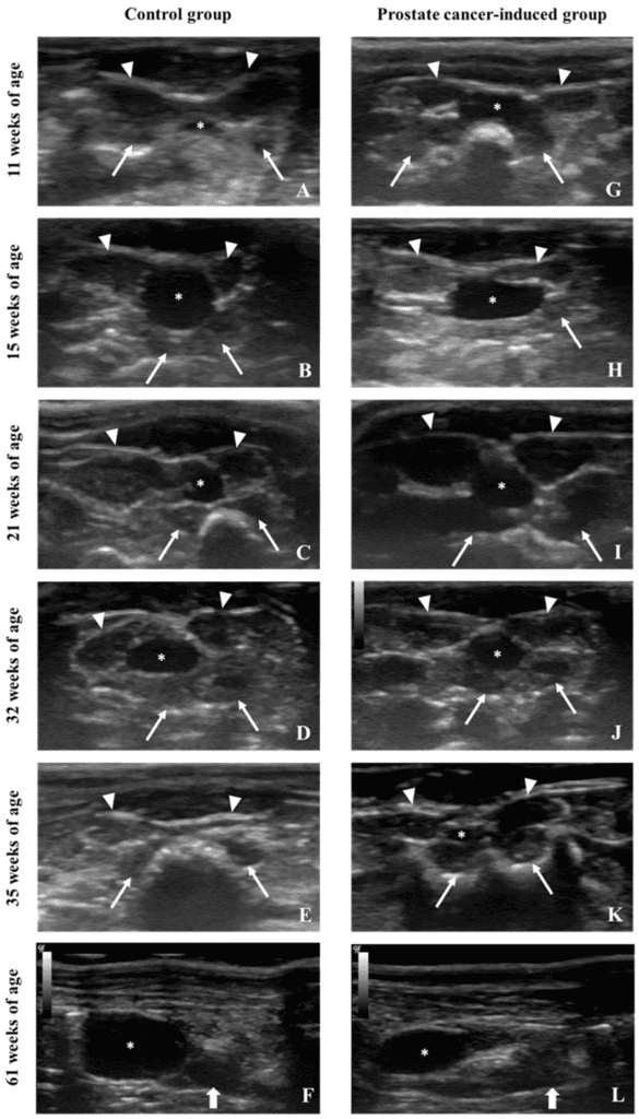 Hershberger Test: How Scientists Measured Anabolic Activity 7 Microscopic images showing the histology of rat seminal vesicles and prostate, illustrating tissue morphology changes relevant to androgenic assessments.