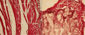 Levator ani muscle and bulbourethral gland histological sections in castrated males from NTII group (HE staining, ×200). Massive dilacerations and ruptures of striated muscular fibbers in levator ani muscle samples and muscular fibbers rarefaction and fluid accumulation increase in volume and weight to bulbourethral glands.